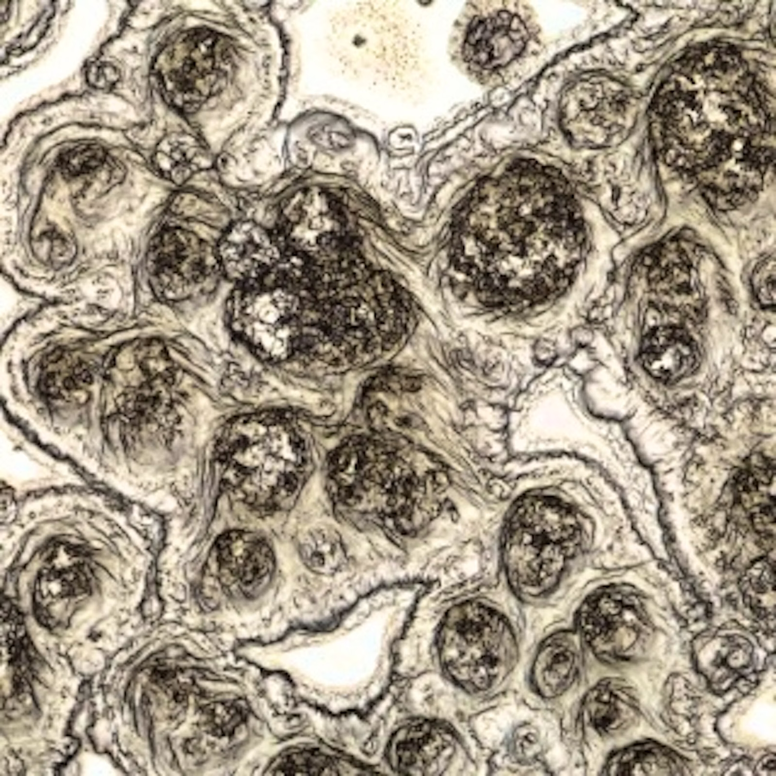 A high-contrast, black and white micrograph showing clustered biological or geological structures.